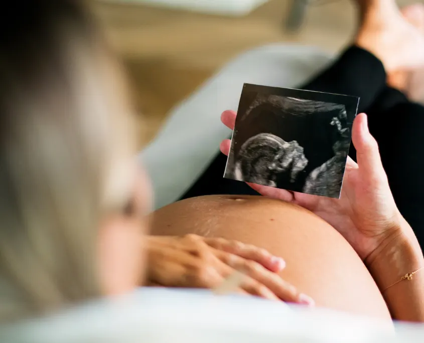 Image en la que le muestran a una ambarazada una ecografía del feto